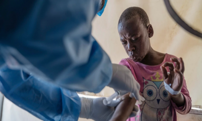 Mpox deaths rise by 107 in a week as Africa CDC calls the toll unacceptable