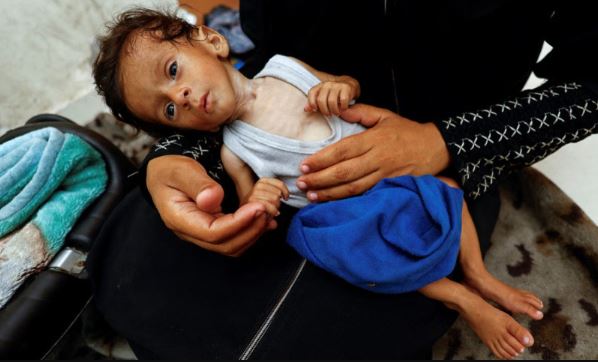 Starving Gaza children too weak to cry, Save the Children head says