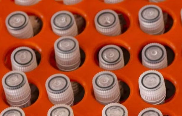 Bangladesh cuts COVID test fees at private hospitals