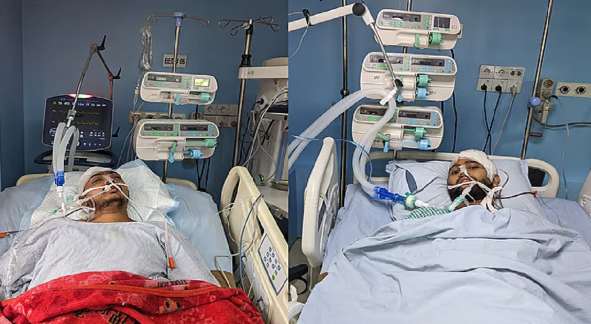 2 CU students on life support, another shifted to Dhaka for advanced treatment