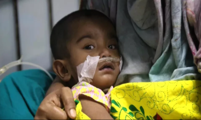 Measles in Bangladesh: Death toll exceeds 350, 9 more die in 24 hrs