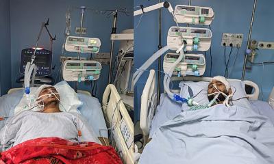 2 CU students on life support, another shifted to Dhaka for advanced treatment