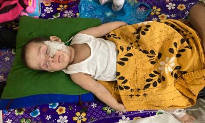 Bangladesh measles death toll crosses 1,000