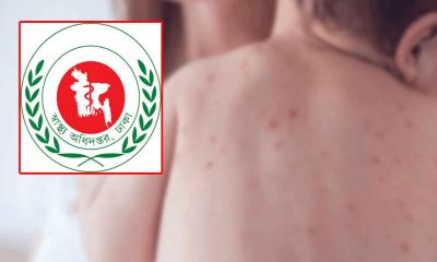 Five more suspected measles deaths reported, total toll reaches 938