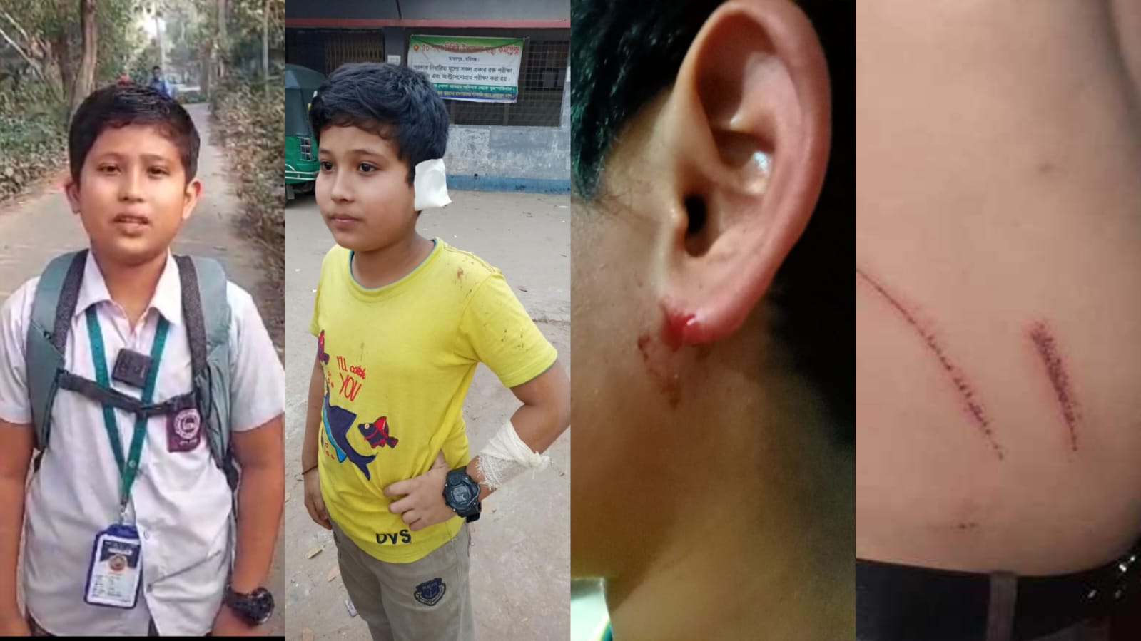 Journalist interview triggers violent backlash: Child and family attacked in Madhabpur