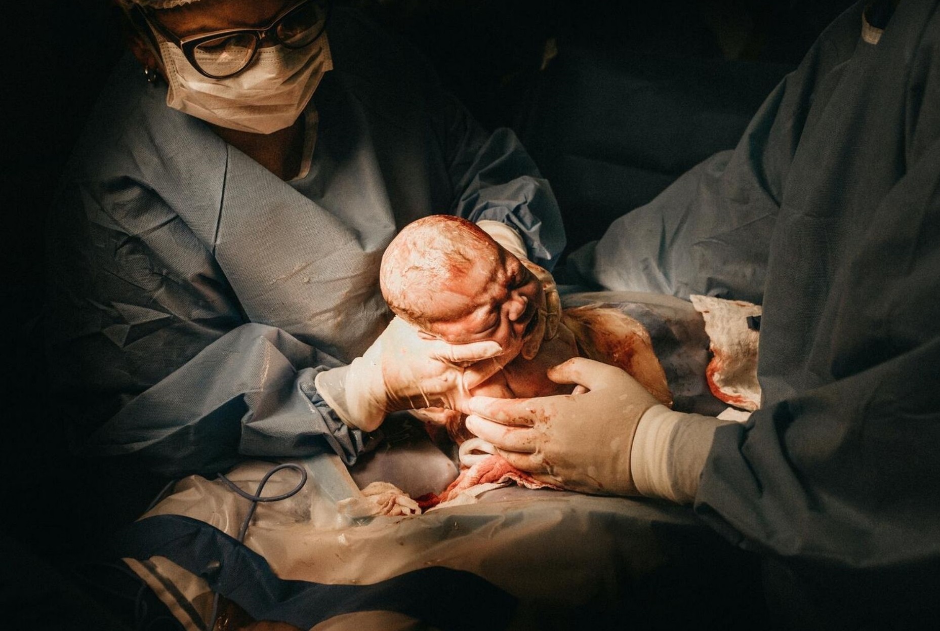 C-section deliveries see eight-fold rise in 14 yrs!