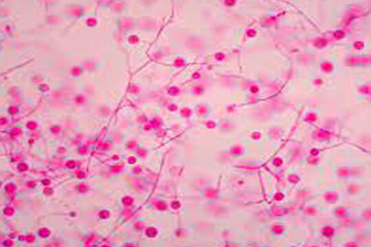 Serious lung infections caused by soil fungi