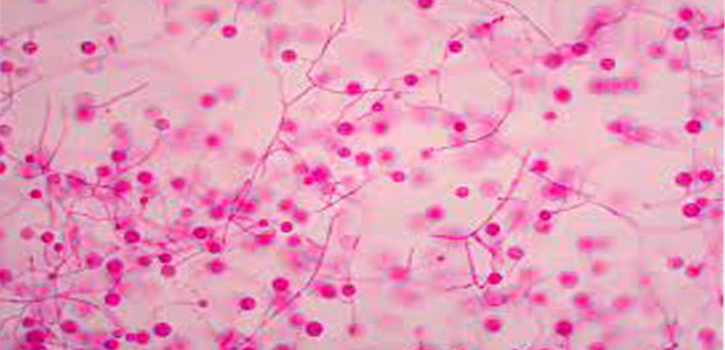 Serious lung infections caused by soil fungi