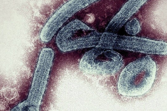 Ghana confirms first cases of deadly Marburg virus
